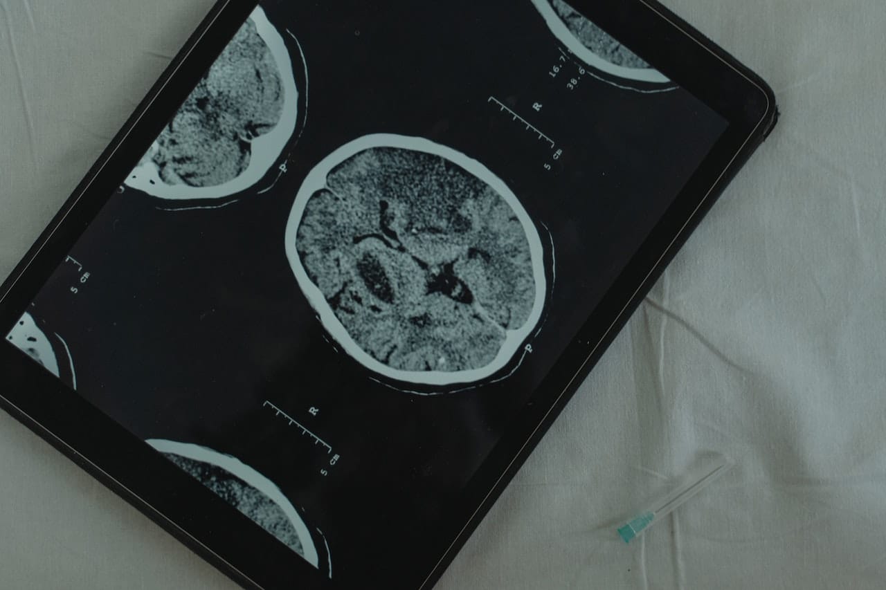 brain image on digital tablet