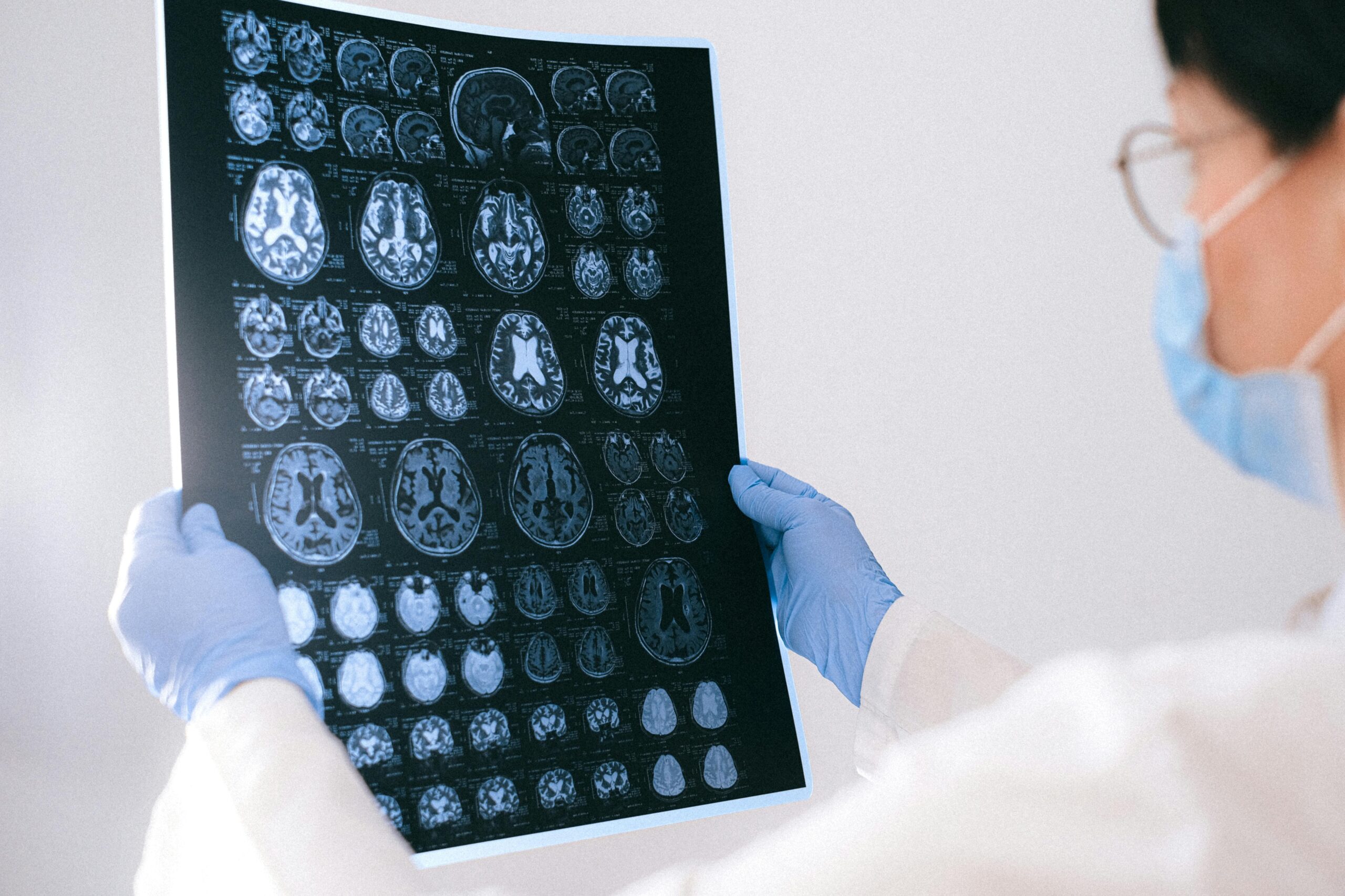 Doctor reviewing MRI representing the impact of brain injury on personal injury claims